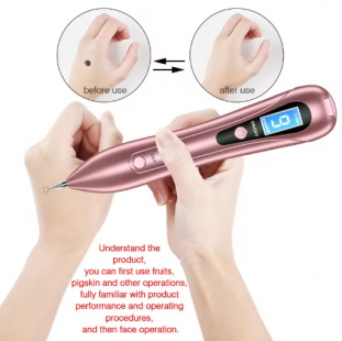 قلم ليزر SMTWDONE لإزالة الشامات والتصبغات | معتمد من FDA 