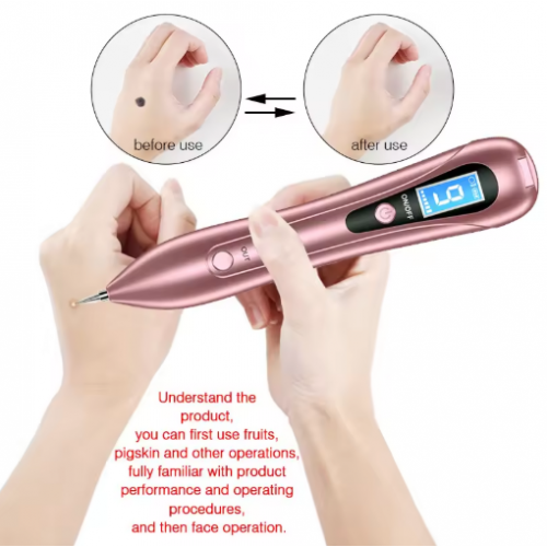 قلم ليزر SMTWDONE لإزالة الشامات والتصبغات | معتمد من FDA 